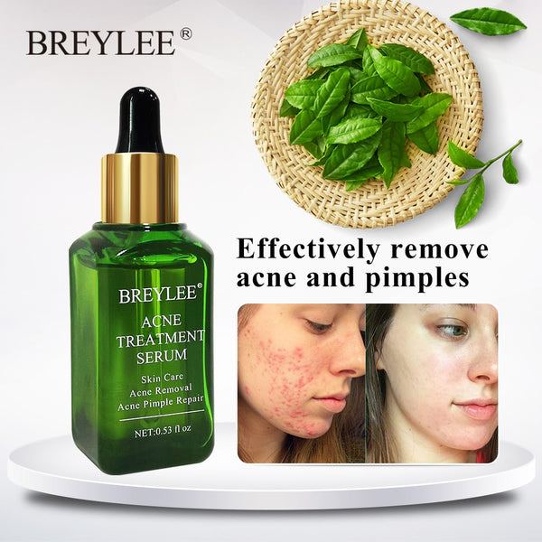 Pimple Repair Serum